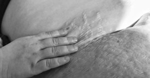 Stretch Marks: I Love My Wife's Symbol of Becoming a Mother