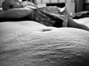 Stretch Marks: I Love My Wife's Symbol of Becoming a Mother